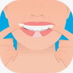 tandblekning-process2-whitening-dentaworks-150x150